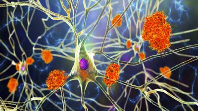 البيض في مواجهة ألزهايمر.. دراسة تكشف ارتباطا محتملا