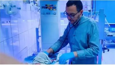 الفيوم.. ولادة نادرة لطفل مصاب بمتلازمة 