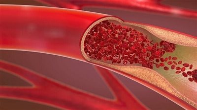 عدو خفي يتربص بقلبك.. علامات لا يجب تجاهلها