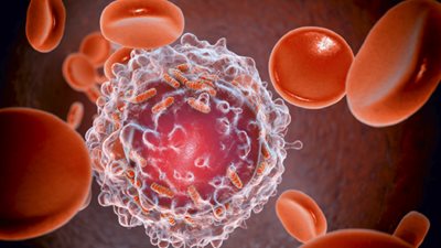 اكتشاف نقطة ضعف جديدة في الخلايا السرطانية تفتح آفاق علاج سرطان الدم