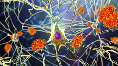 خلطة دوائية ترمم الأعصاب التالفة بسبب التصلب اللويحي