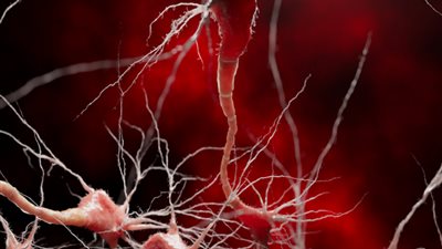 اختراق علمي مذهل.. حقنة نانوية تعالج ألزهايمر من جذوره