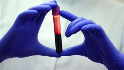 فحص دم جديد يكشف 50 نوعا من السرطان قبل ظهور الأعراض