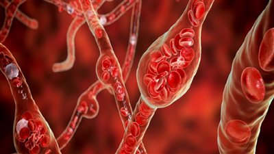 4 حقائق عن الكوليسترول لا ينبغي تجاهلها