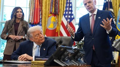 الرئيس الأمريكي يخفي مجددا الكدمة الزرقاء أمام عدسات الكاميرا 