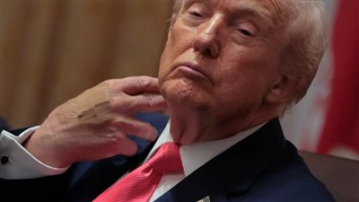 ترامب يظهر مرة أخرى بضمادة على معصمه