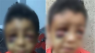 الداخلية تكشف حقيقة صور متداولة عن تعرض طفل للضرب داخل مدرسة بقنا