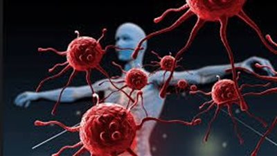 علامات شائعة في الجسم قد تكشف السرطان مبكراتعبيرية