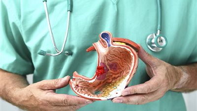 أخصائي أورام يوضح طبيعة سرطان المعدة