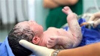 ولادة مبكرة - تعبيرية    