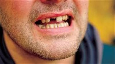 حادثة مؤلمة.. 