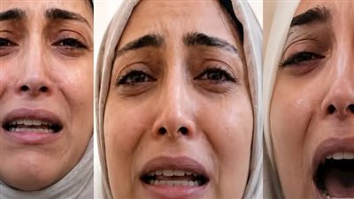 تقرير طبي يكشف حجم إصابات طبيبة أسنان شبرا الخيمة.. والنقابة تلاحق المعتدين قانونياً